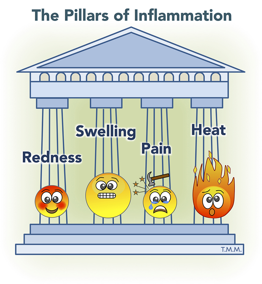 Figure 1 - The pillars of inflammation.